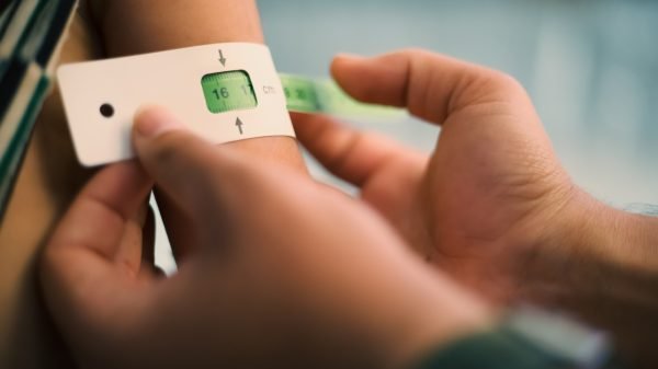 Desnutrición crónica afecta al 50% de los niños en Guatemala