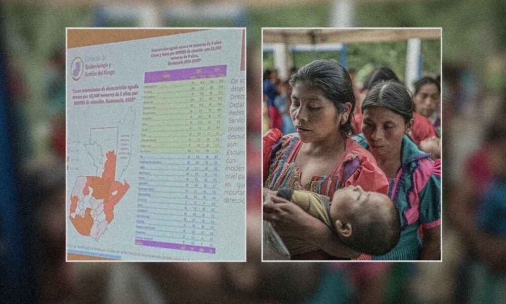 Preocupa alza de desnutrición aguda en menores guatemaltecos en 2025, según datos oficiales